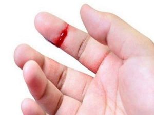 Đứt tay chảy máu điềm gì? Luận giải điềm báo tốt xấu