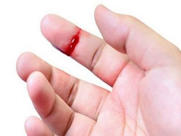 Đứt tay chảy máu điềm gì?