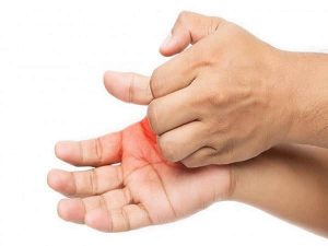 Ngứa lòng bàn tay là điềm gì? tốt hay xấu, hên hay xui
