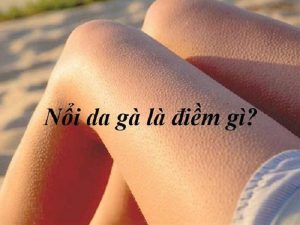 Hiện tượng nổi da gà có điềm gì tại các vị trí trên cơ thể