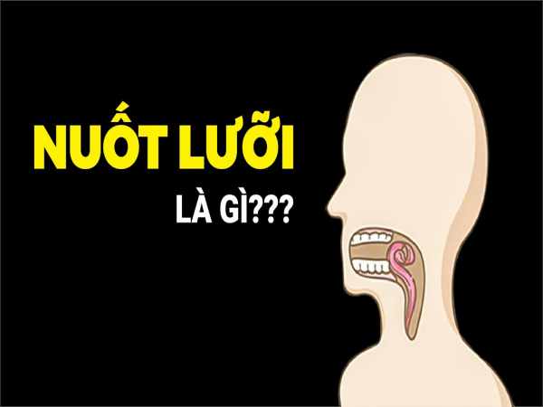 Nuốt lưỡi là gì?